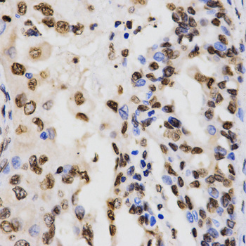 Rabbit Anti-H3K9me3 Antibody, Immunohistochemistry (IHC) – Cat# MBS126185