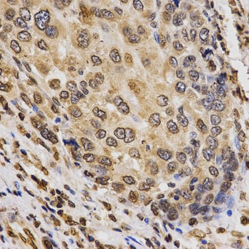 Rabbit Anti-H3K9me3 Antibody, Immunohistochemistry (IHC) – Cat# MBS126185