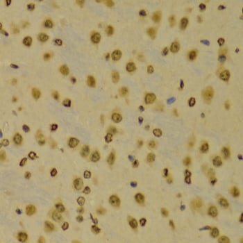 Rabbit Anti-H3K9me3 Antibody, Immunohistochemistry (IHC) – Cat# MBS126185