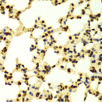 Rabbit Anti-H3K9me3 Antibody, Immunohistochemistry (IHC) – Cat# MBS126185