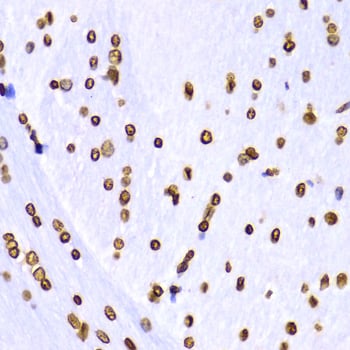 Rabbit Anti-H3K9me3 Antibody, Immunohistochemistry (IHC) – Cat# MBS126185