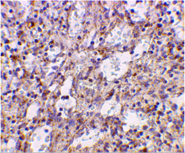 Rabbit Anti-TLR2 Polyclonal Antibody, Immunohistochemistry (IHC) – Cat# MBS150600