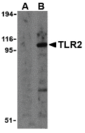 Rabbit Anti-TLR2 Polyclonal Antibody – Cat# MBS150600