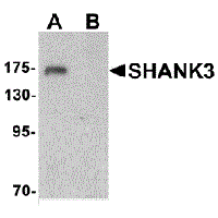 SHANK3 Blocking Peptide – Cat# MBS152000