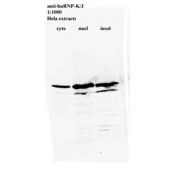 Mouse Anti-HNRNPK Monoclonal Antibody – Cat# MBS375183