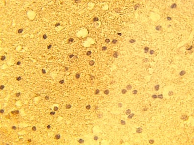 Immunohistochemistry (IHC)