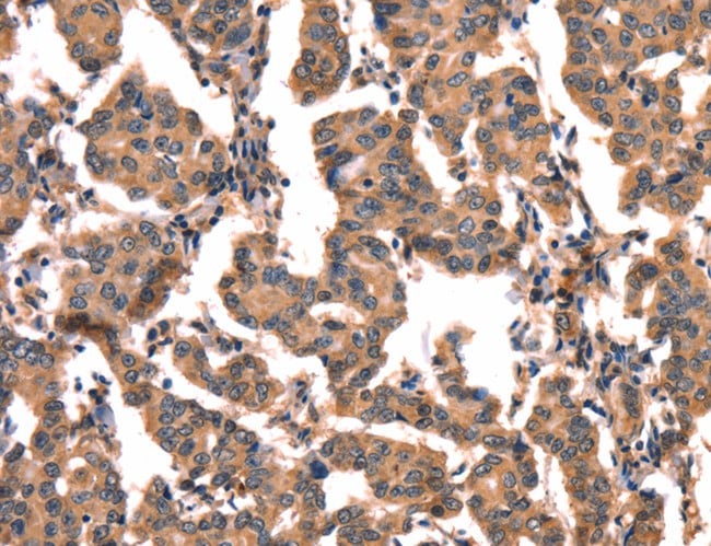 Immunohistochemistry (IHC)