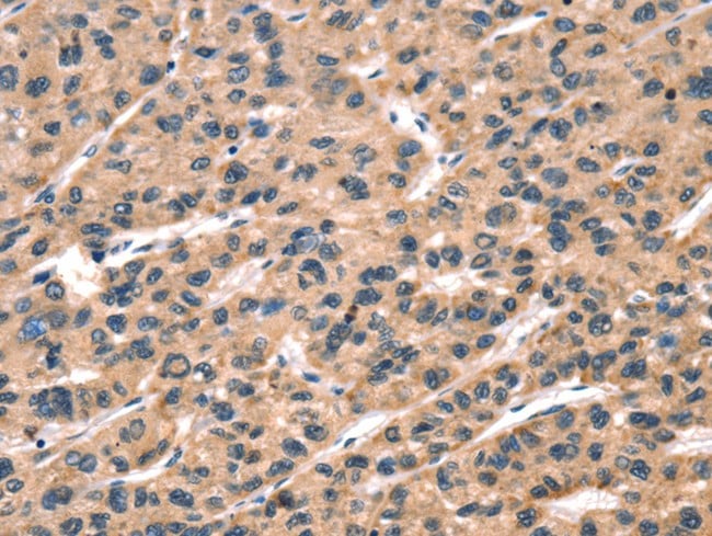 Immunohistochemistry (IHC)