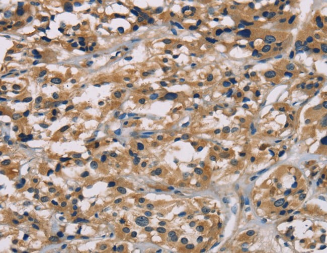 Immunohistochemistry (IHC)