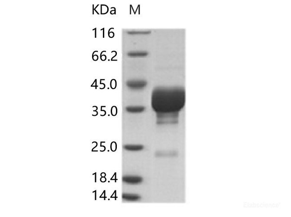 VP4 Recombinant Protein – Cat# MBS2569466