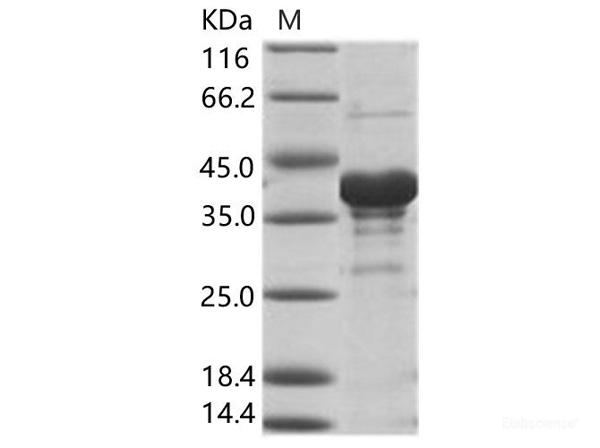 VP40 Recombinant Protein – Cat# MBS2569493