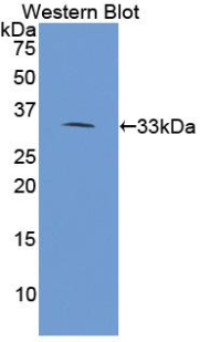 Rabbit Anti-PLA2R1 Antibody – Cat# MBS2017615