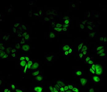 Rabbit Anti-HSPB1 Polyclonal Antibody, Immunohistochemistry (IHC) – Cat# MBS2026815