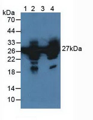 Rabbit Anti-HSPB1 Polyclonal Antibody – Cat# MBS2026815