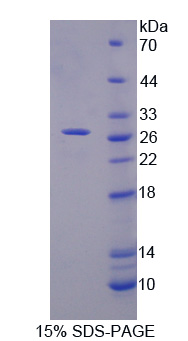 MID1 Recombinant Protein, SDS-Page – Cat# MBS2030329