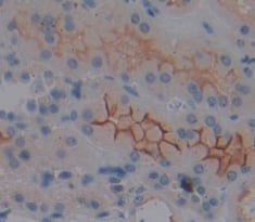 Rabbit Anti-ND1 Polyclonal Antibody, Immunohistochemistry (IHC) – Cat# MBS2032344