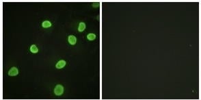Rabbit Anti-Histone H4, Acetylated Polyclonal Antibody, Immunofluorescence (IF) – Cat# MBS6000669