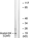 Rabbit Anti-Histone H4, Acetylated Polyclonal Antibody, Western Blot (WB) – Cat# MBS6000669
