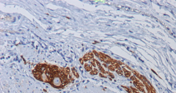 Mouse Anti-CD56 Monoclonal Antibody – Cat# MBS6122177