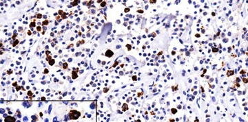 Mouse Anti-Lambda Chain Monoclonal Secondary Antibody – Cat# MBS6122303
