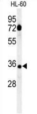Rabbit Anti-CD80 Polyclonal Antibody – Cat# MBS6283510