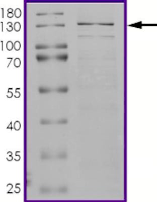AapCas12b Recombinant Protein – Cat# MBS516659