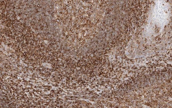 Mouse Anti-HLA Monoclonal Antibody – Cat# MBS570333