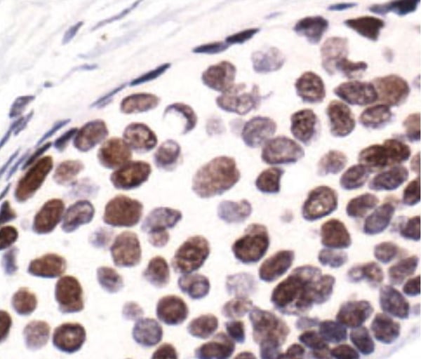 Rabbit Anti-HIST4H4 Polyclonal Antibody, Immunohistochemistry (IHC) – Cat# MBS614919