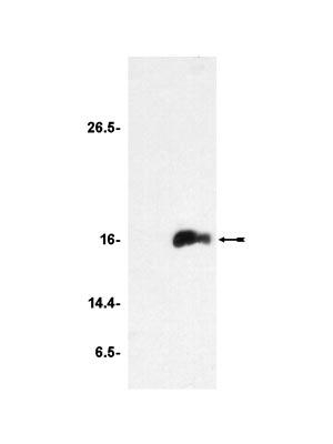 Rabbit Anti-TTHERM_00189180 Polyclonal Antibody – Cat# MBS622059