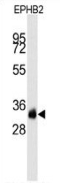 Mouse Anti-EPHB2 Monoclonal Antibody – Cat# MBS632528