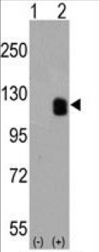 Mouse Anti-EPHB2 Monoclonal Antibody, Western Blot (WB) – Cat# MBS632528