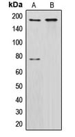 Rabbit Anti-CUX1 Polyclonal Antibody – Cat# MBS820580