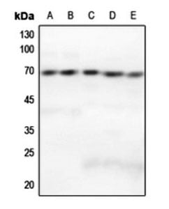 Rabbit Anti-GRK5 Polyclonal Antibody – Cat# MBS821621