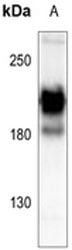 Rabbit Anti-PDGFRA Polyclonal Antibody – Cat# MBS821212