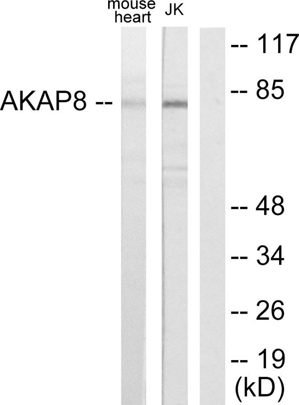 Anti-AKAP8 Antibody, Immunohistochemistry (IHC) – Cat# MBS856630