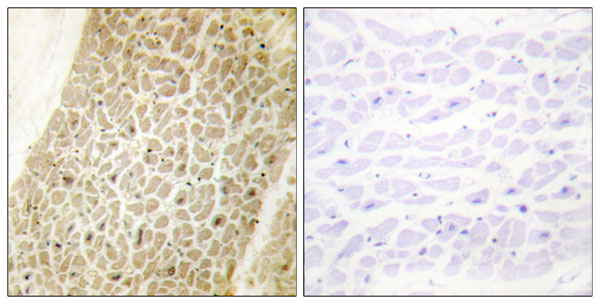 Anti-AKAP8 Antibody – Cat# MBS856630