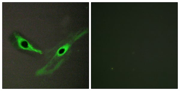 Anti-ICK Antibody, Immunohistochemistry (IHC) – Cat# MBS856636