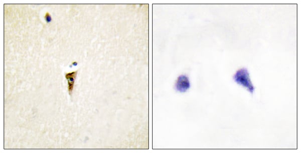 Anti-ICK Antibody – Cat# MBS856636