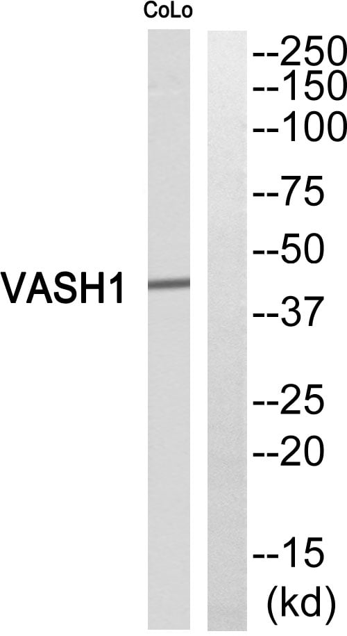 Anti-VASH1 Antibody – Cat# MBS856263