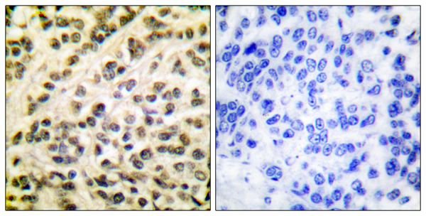 Anti-FLI1 Antibody – Cat# MBS856264
