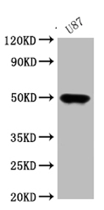Rabbit Anti-ATAT1 Polyclonal Antibody – Cat# MBS7107311