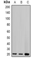 Rabbit Anti-CETN2 Polyclonal Antibody – Cat# MBS8245362