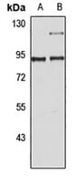 Rabbit Anti-PGC1A Polyclonal Antibody – Cat# MBS8307747