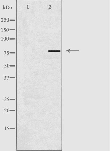 Rabbit Anti-ACSL6 Polyclonal Antibody – Cat# MBS9605597