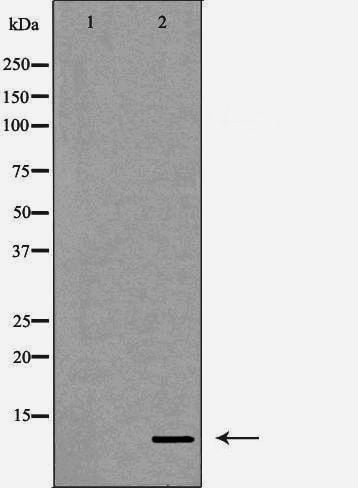 Rabbit Anti-DBI Polyclonal Antibody, Western Blot (WB) – Cat# MBS9607944