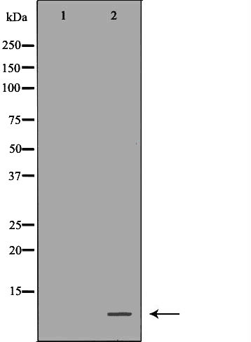 Rabbit Anti-TFF3 Polyclonal Antibody, Western Blot (WB) – Cat# MBS9607387