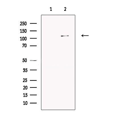 Rabbit Anti-XPO1 Polyclonal Antibody – Cat# MBS9612123