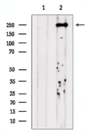 Rabbit Anti-POLQ Polyclonal Antibody, Western Blot (WB) – Cat# MBS9612322