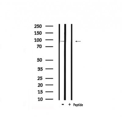 Rabbit Anti-MLK3 Polyclonal Antibody – Cat# MBS9614080