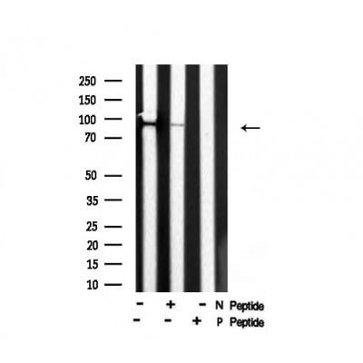 Rabbit Anti-MLK3 Polyclonal Antibody, Western Blot (WB) – Cat# MBS9614080